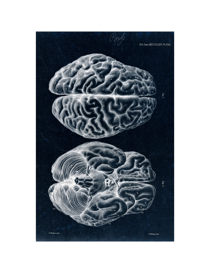 Deanna Bowen, John Marshall, Brain of an African Bushwoman: Two Figures, Views from Above and Below. Lithograph by E.M. Williams after H. Watkins, 1864, 2020. Courtesy of the artist and MKG127